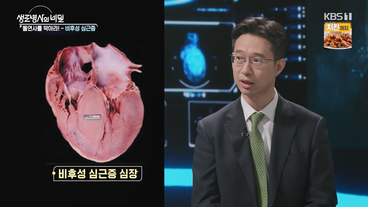 생로병사의 비밀.E912.240523p-NEXT.mp4_20240523_201954.360.jpg