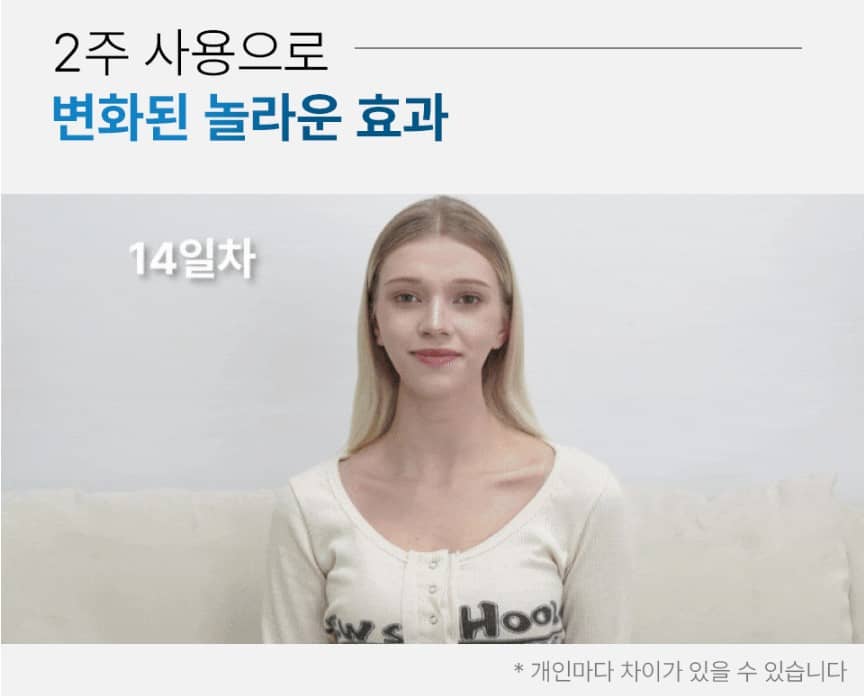 혼바디 브이롤러 EMS 마사지기 부작용