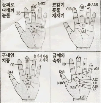 두통 수지침 편두통 혈자리_10