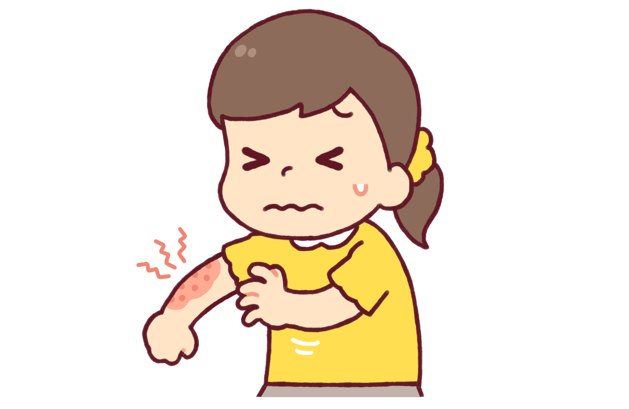  대상포진 증상