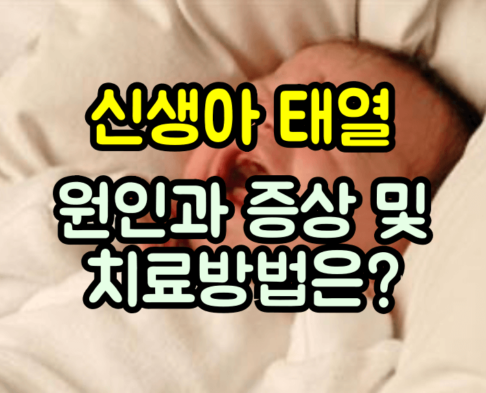 신생아 태열 치료방법