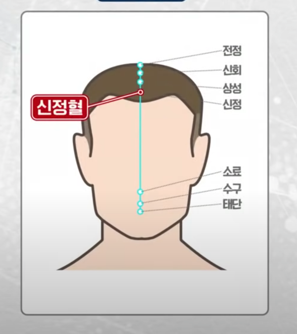 흰머리와 관련된 질병