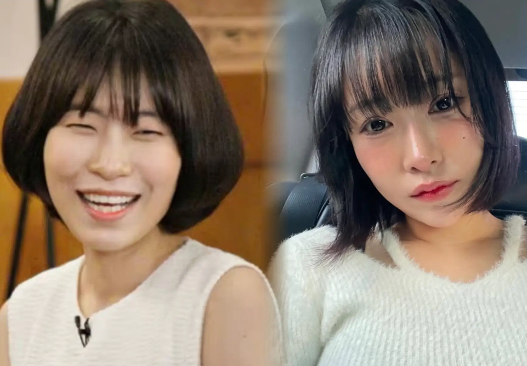 이세영 성형 전후