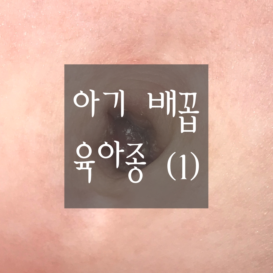  [신생아 배꼽 육아종(1)] 배꼽 육아종이란? 원인과 증상˙치료˙검사˙예방방법 등에 대해 알아봅니다.