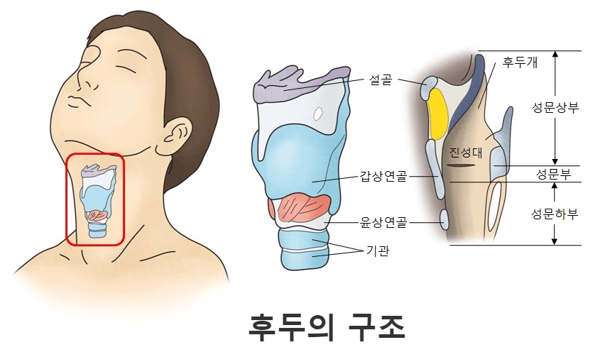  후두암. 후두란.후두암증상.후두암병기.후두암 원인.