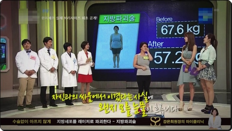 셀룰라이트 제거까지 지방파괴술 효과, 뱃살 다이어트부터 복부 1