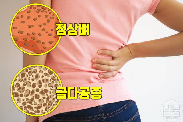 흑염소 효능 부작용 염소탕 효능 골다공증 산후조리