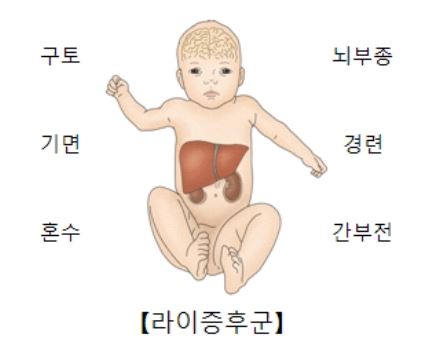 라이 증후군 설명