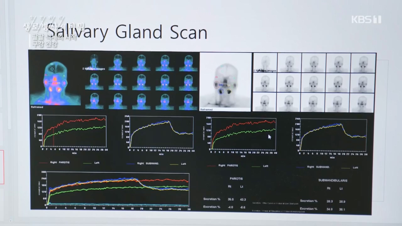 생로병사의 비밀.E894.240118p.H264-F1RST.mp4_20240118_195343.294.jpg