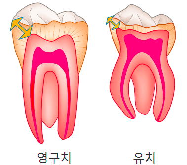  어린이 유치를 치료 해야 되는 경우와 발치 해야 되는 경우