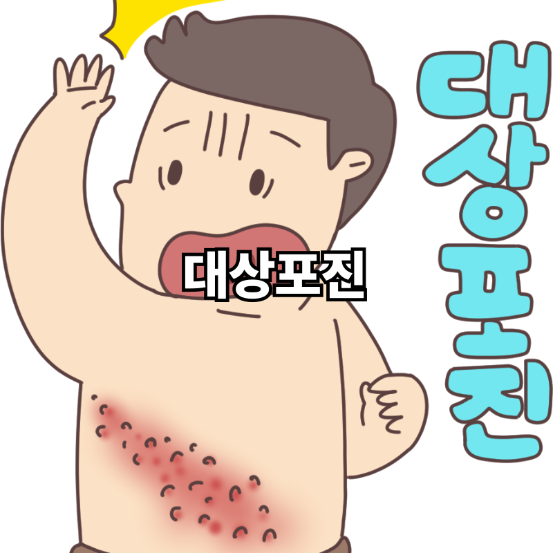면역력 떨어질 때 대상포진 위험 증가｜원인과 취약계층 총정리