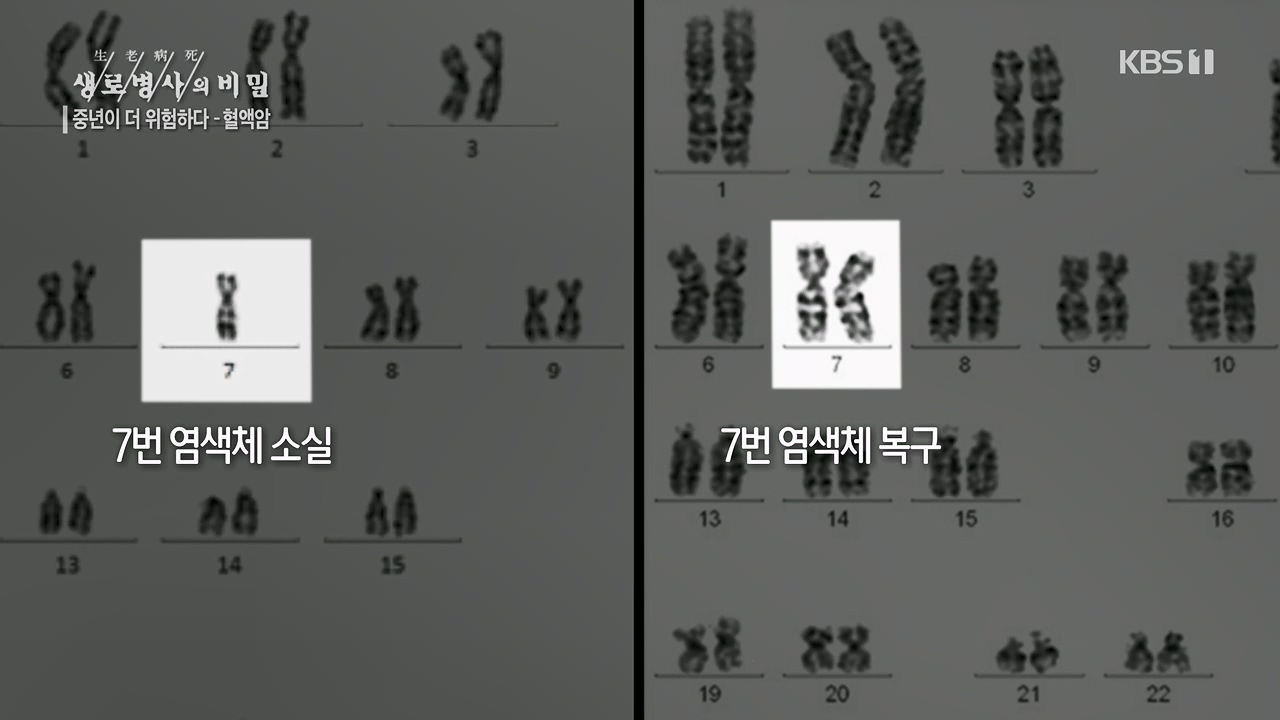 생로병사의 비밀.E868.230511p.H264-F1RST.mp4_20230511_201642.331.jpg
