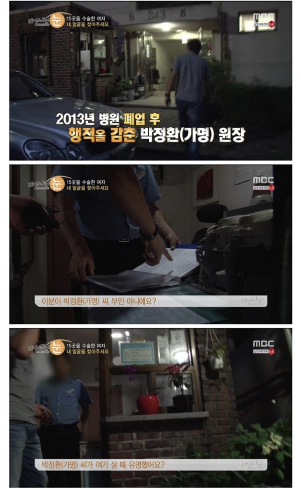 성형수술 피해