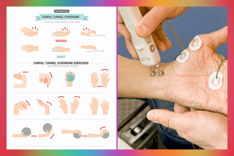 손목 터널 증후군 운동 및 치료
