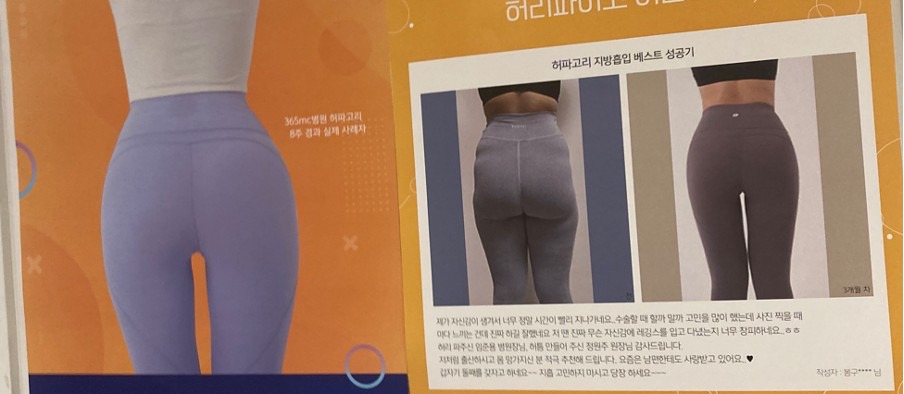 허파고리 수술