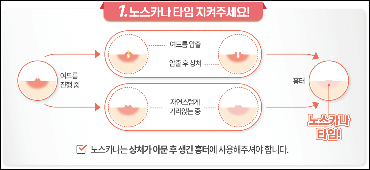 노스카나겔 연고