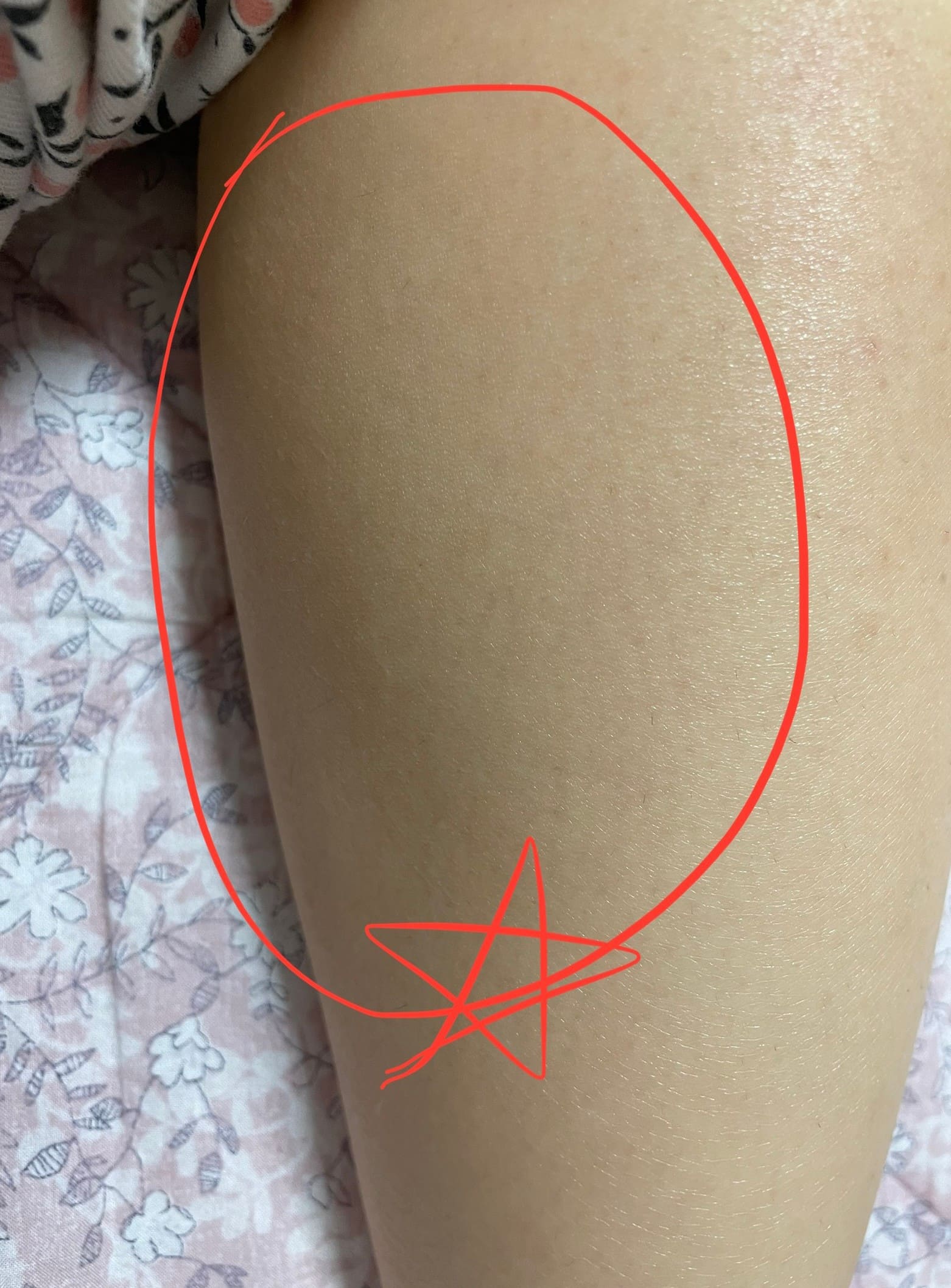 카밍 이미지