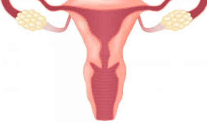  자궁내막증 치료방법과 정의에 대하여