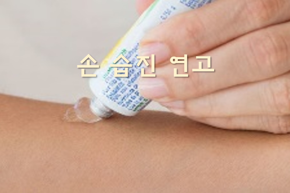 손가락 습진, 연고에만 의존하고 9