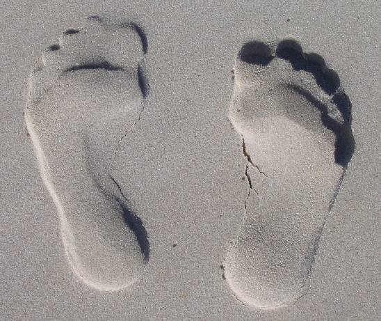 통풍 환자를 위한 규칙적인 운동과 요산 배출법