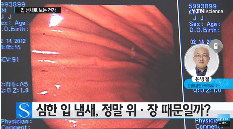  입냄새 심한 이유 제거방법은?