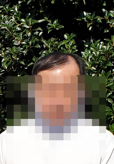 탈모약 먹기 시작할 즈음 여행사진 2