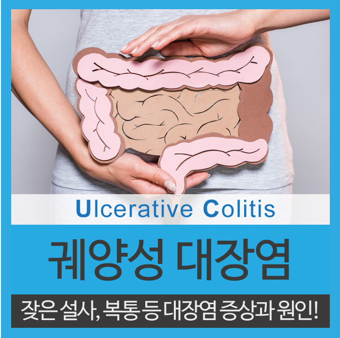  궤양성 대장염 원인과 증상 복통과 설사가 증거