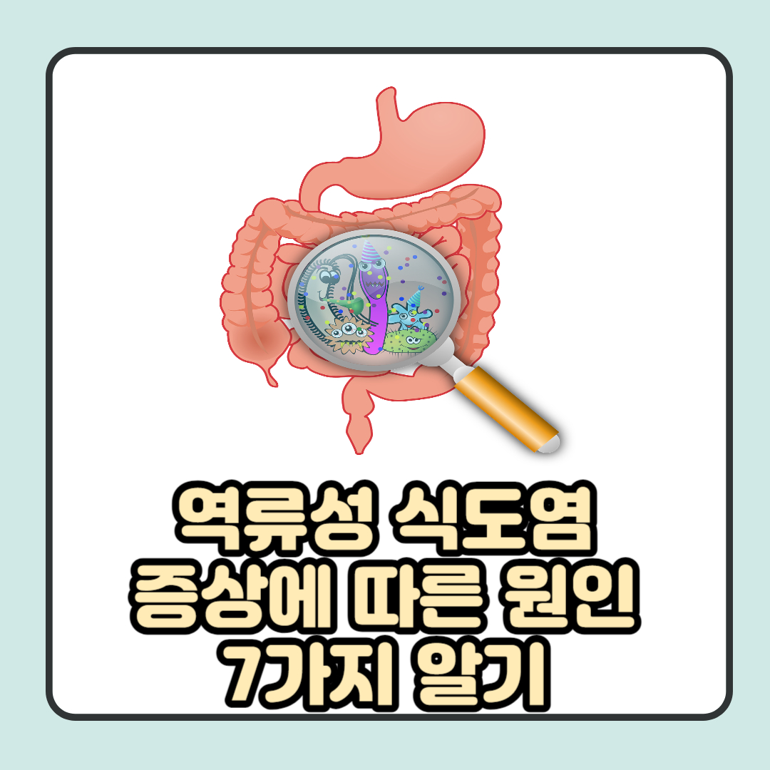  역류성 식도염 증상에 따른 원인 총 7가지 알아보기