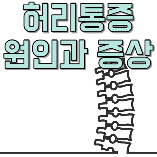  허리 뒤로 젖혀지지 않아요. 허리 디스크? 척추관협착증? 후관절통?