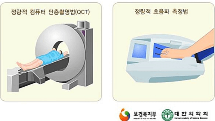 골다공증-검사중인-여자