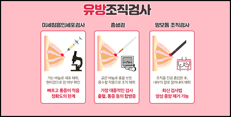 유방조직검사