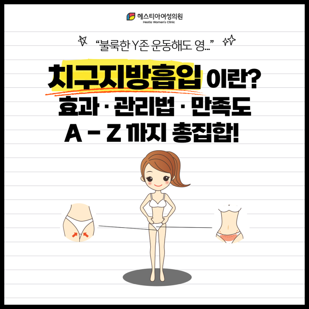 Y존지방흡입 아랫배지방흡입 다이어트 해도 볼록한 Y존 해결하려면 -치구지방흡입 편-