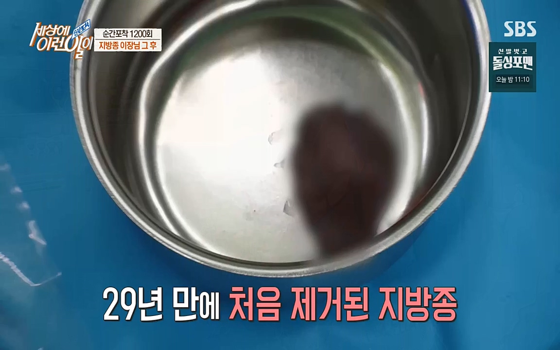 순간포착 세상에 이런일이.E1200.221005p-NEXT.mp4_20221005_201441.416.jpg