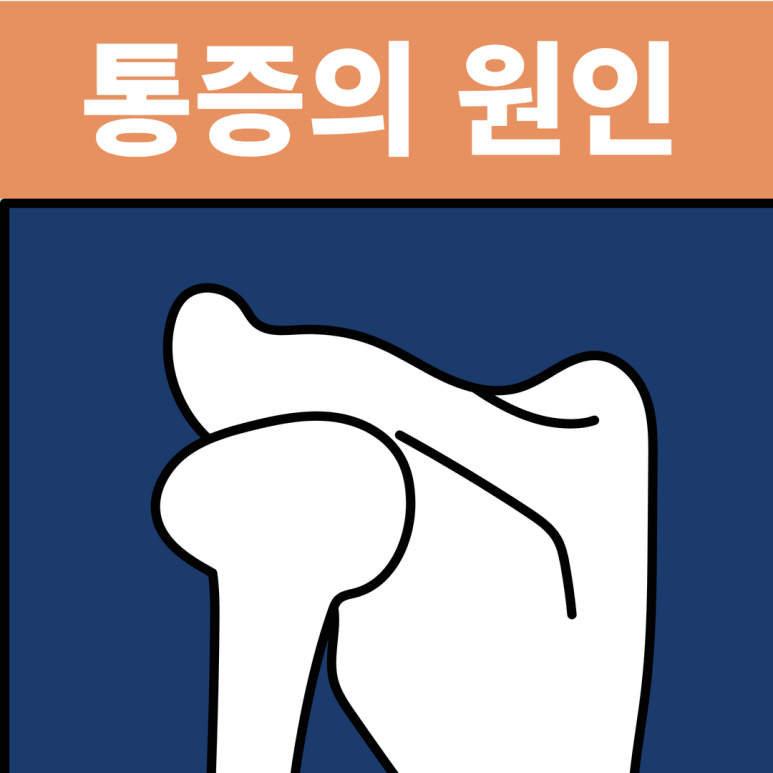 왼쪽 날개뼈 통증의 원인과 치료 6