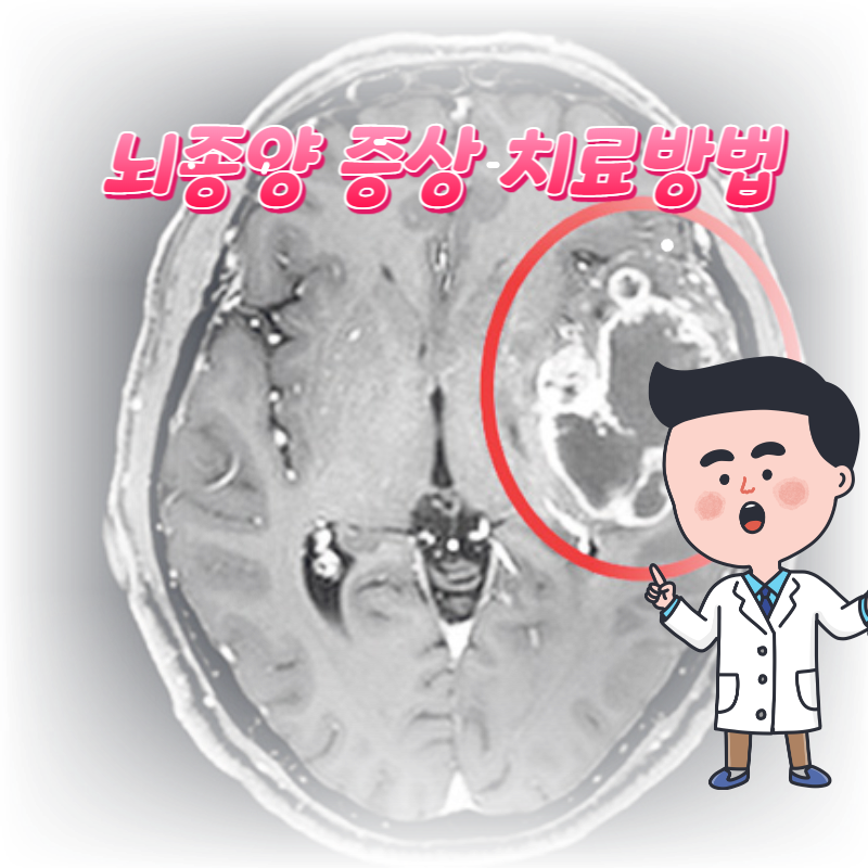  뇌종양 증상 치료방법 놓치면 안됩니다.