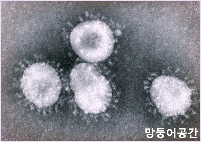  폐위치, 폐렴증상과 코로나 바이러스 차이 폐가 손상되는 이유