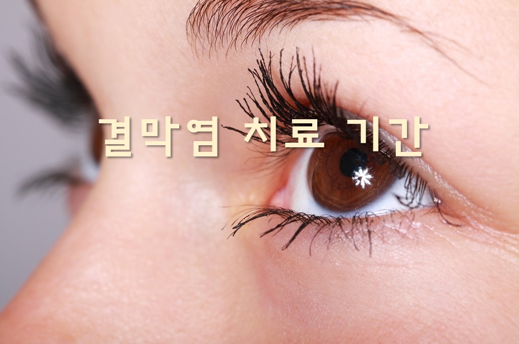 결막염을 미리 알고 대처해 봅시다. 10