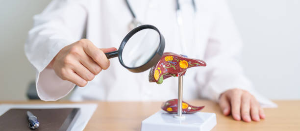 Fatty Liver Isn't Just for Alcoholics: Understanding Non-Alcoholic Fatty Liver Disease.