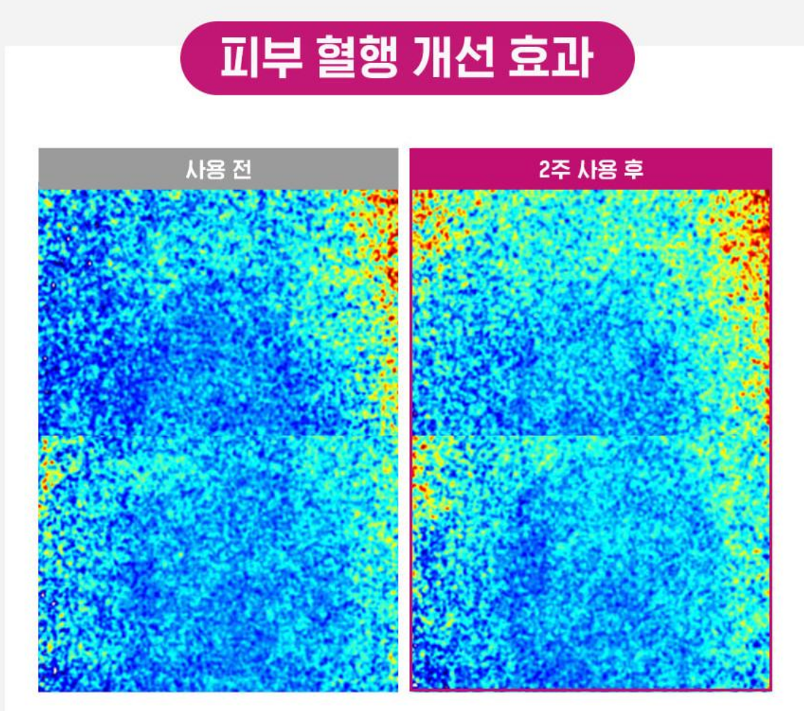 종근당 괄사 목주름 크림 탄력세럼 효과