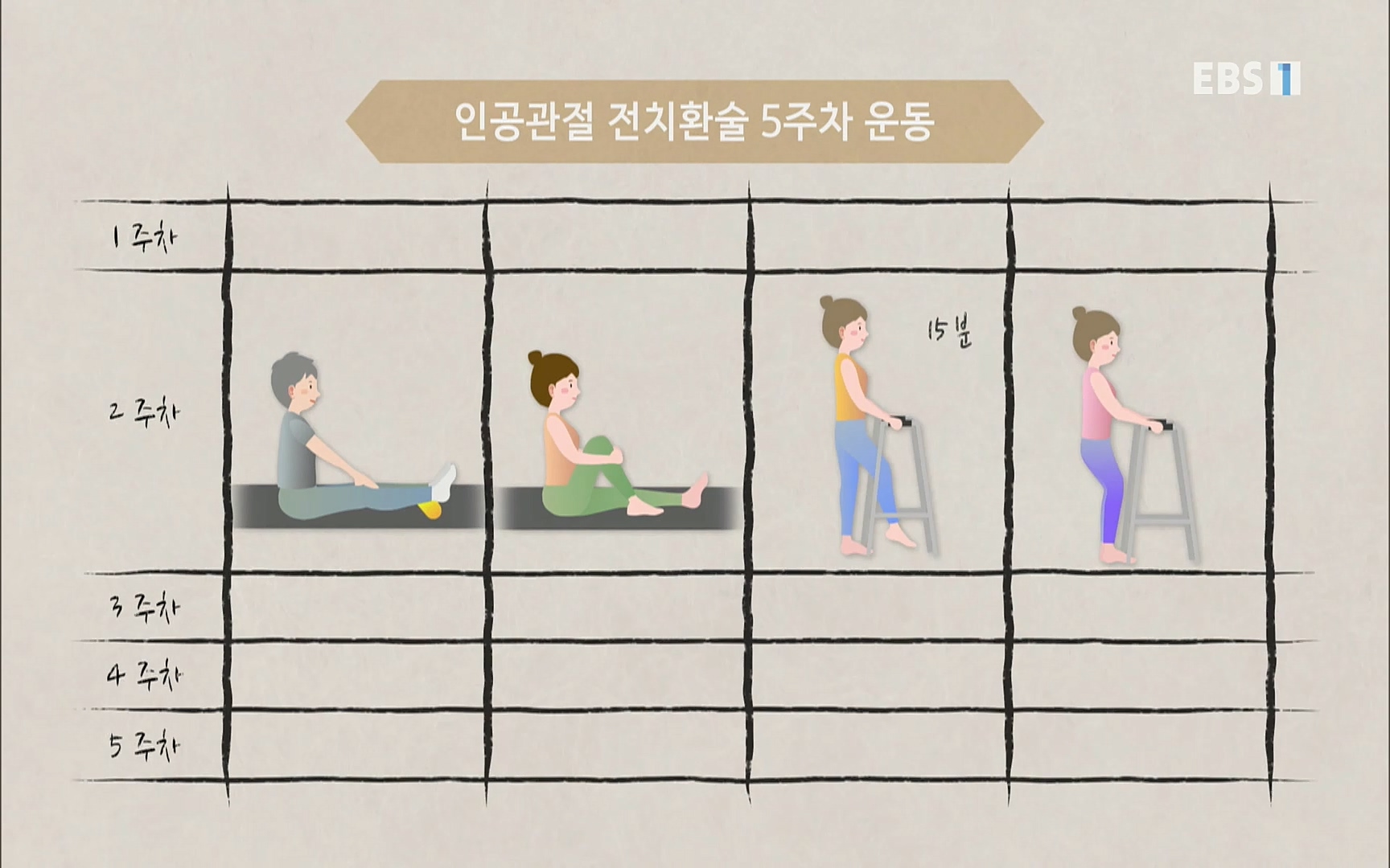 EBS 명의 헬스케어 - TV - 교육의 중심 EBS무릎 건강 프로젝트 2부 새 무릎으로 사는 법 .mp4_20220726_202340.757.jpg