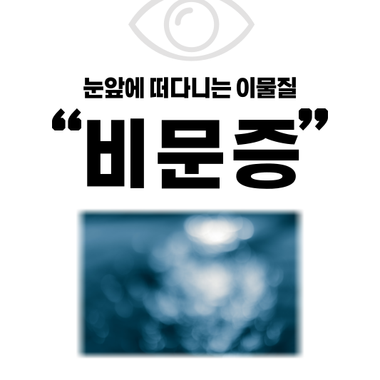  눈앞에 떠다니는 이물질, 비문증 증상부터 예방법까지 완벽 정복!