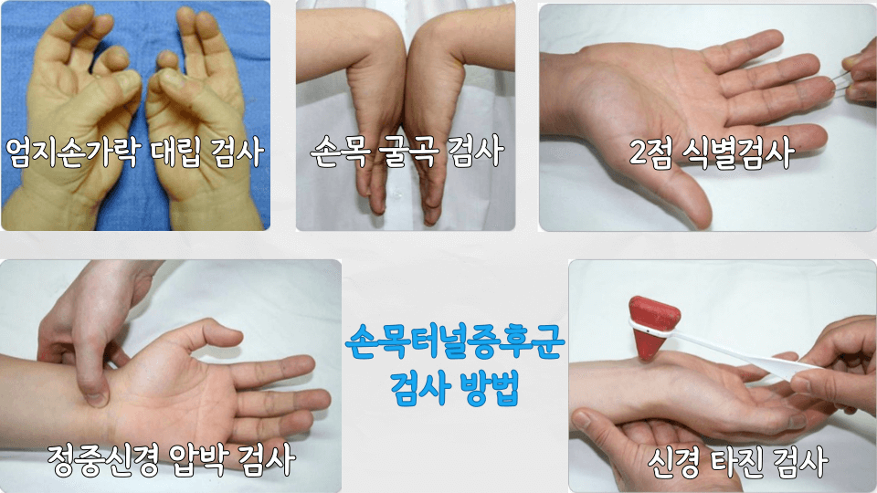 손목터널증후군검사방법