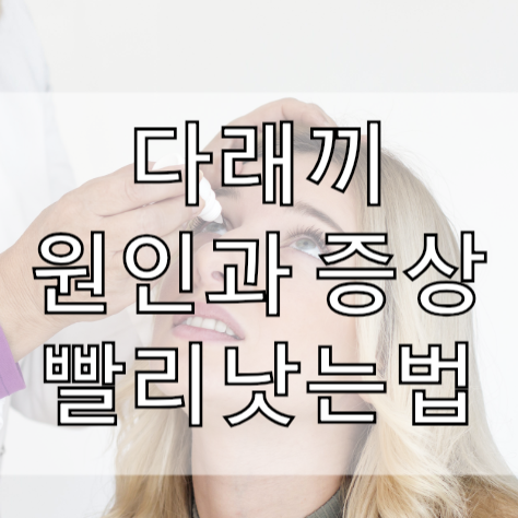  다래끼 빨리낫는법 원인과 해결법