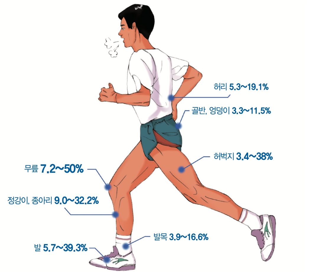  달리기 부상, 무릎 통증의 원인과 치료