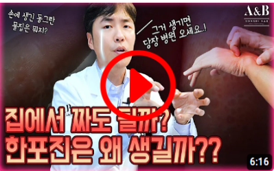 손가락 수포의 원인과 증상