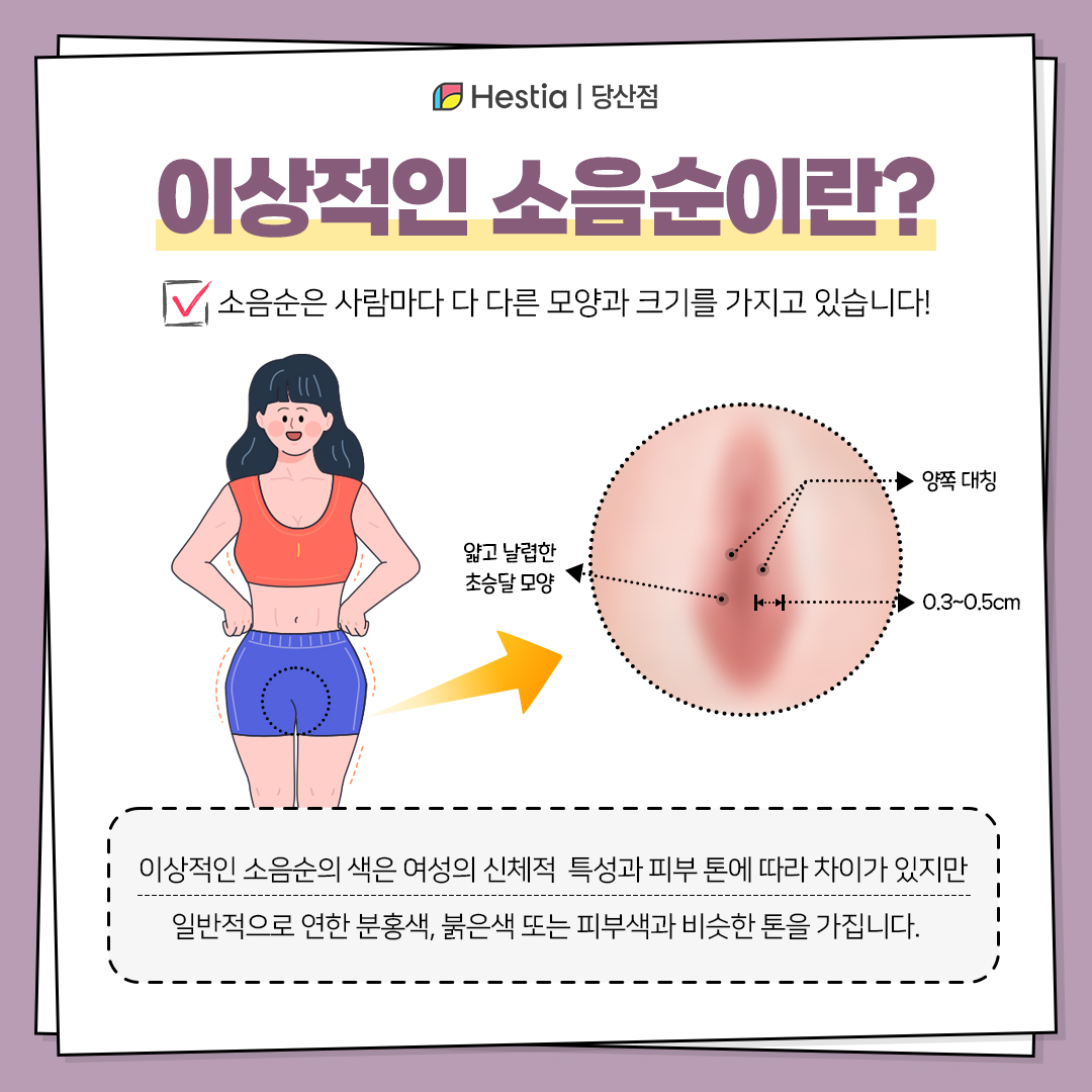 정상적인 소음순 색은?