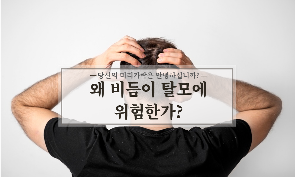 비듬이 탈모에 위험한가?
