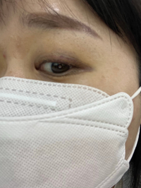 아이라인반영구 16