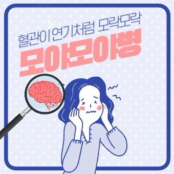  모야모야병 원인, 증상, 유전, 수술, 치료 등 알아보기