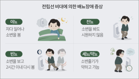 배뇨장애 증상